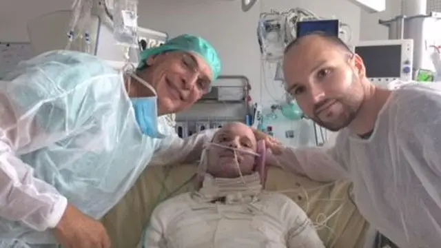 Imagen de los gemelos y el cirujano. AEP