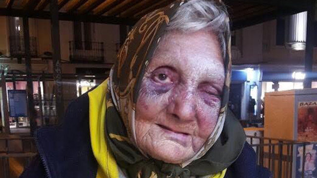 Mujer agredida en Madrid. TWITTER LAGARDER81