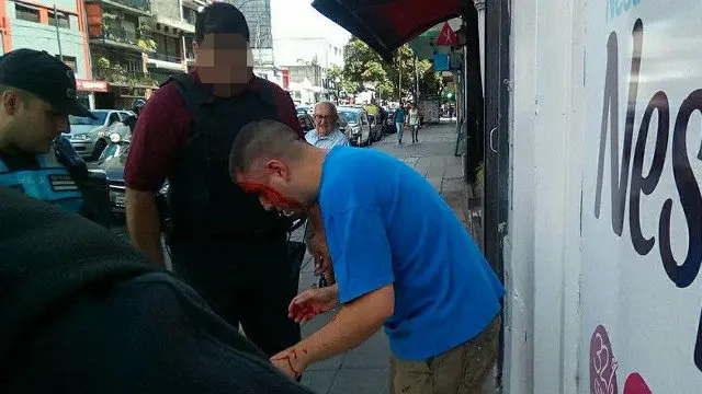 El acosador, tras ser golpeado por el padre de la niña. FACEBOOK