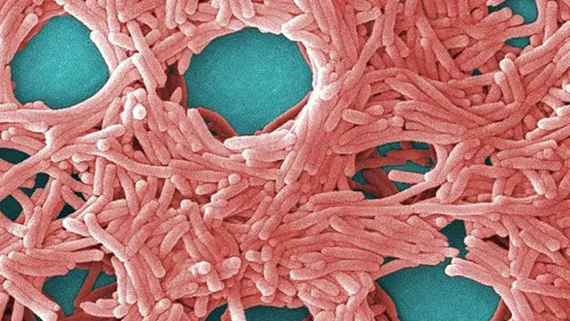 La bacteria Legionella.AEP