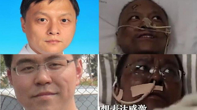 A pel dos doutores Yi Fan e Hu Weifeng escureceuse notablemente. CCTV