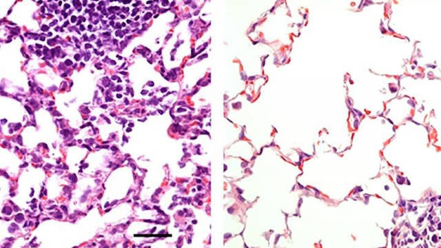 Comparación del tejido pulmonar de un ratón vacunado con el de uno que no lo está. EFE