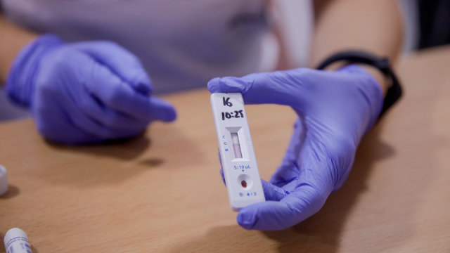 Persoal sanitario mostra o resultado dun test rápido de detección de anticorpos. EUROPA PRESS
