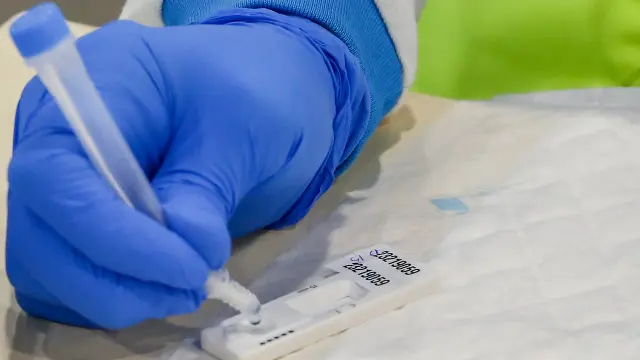 Test de antígenos. EP