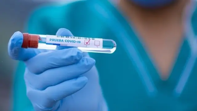 Proba para detectar o covid-19. EFE