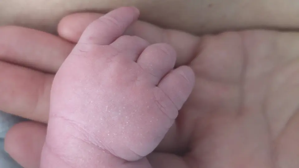 Manos de un recién nacido. INTERNET