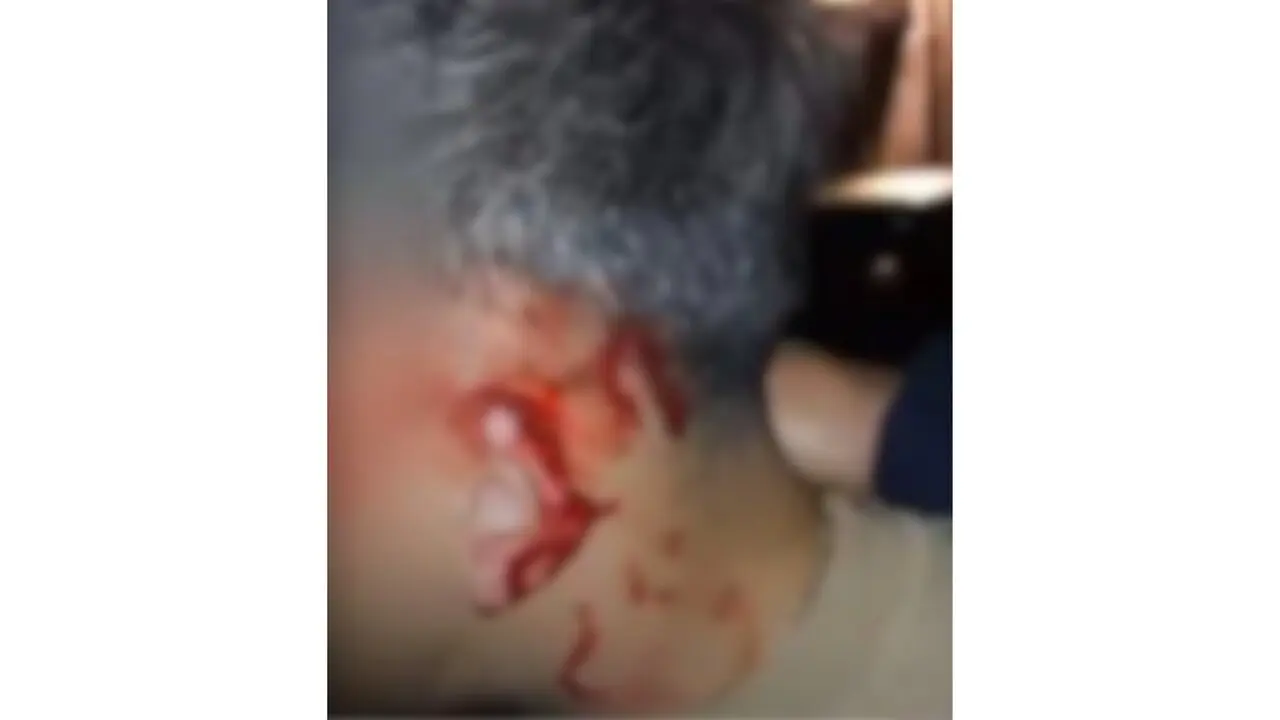 La oreja ensangrentada despu&eacute;s del mordisco. AGN