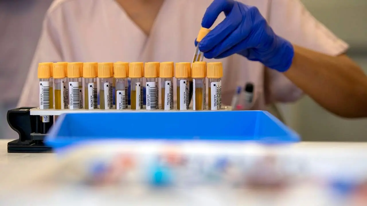 Muestras de sangre. AEP