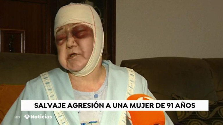 Anciana agredida en  L'Hospitalet. ANTENA 3