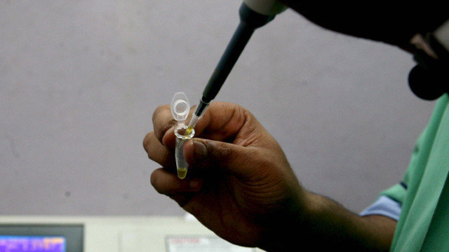 Un técnico prepara una muestra de sangre para analizarla. PIYAL ADHIKARY