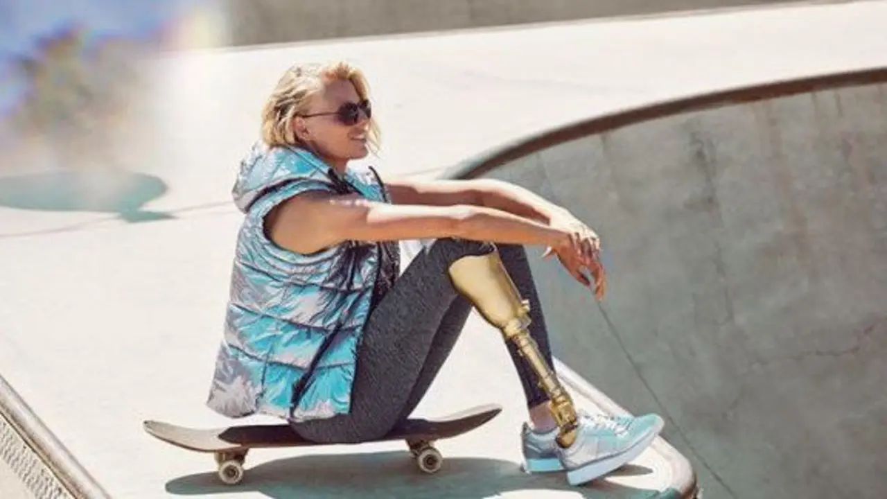 Lauren Wasser, en una foto publicada en sus redes sociales. INSTAGRAM