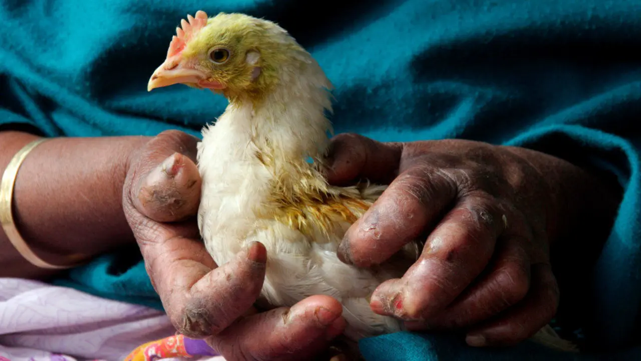 Manos de una enferma de lepra. AEP