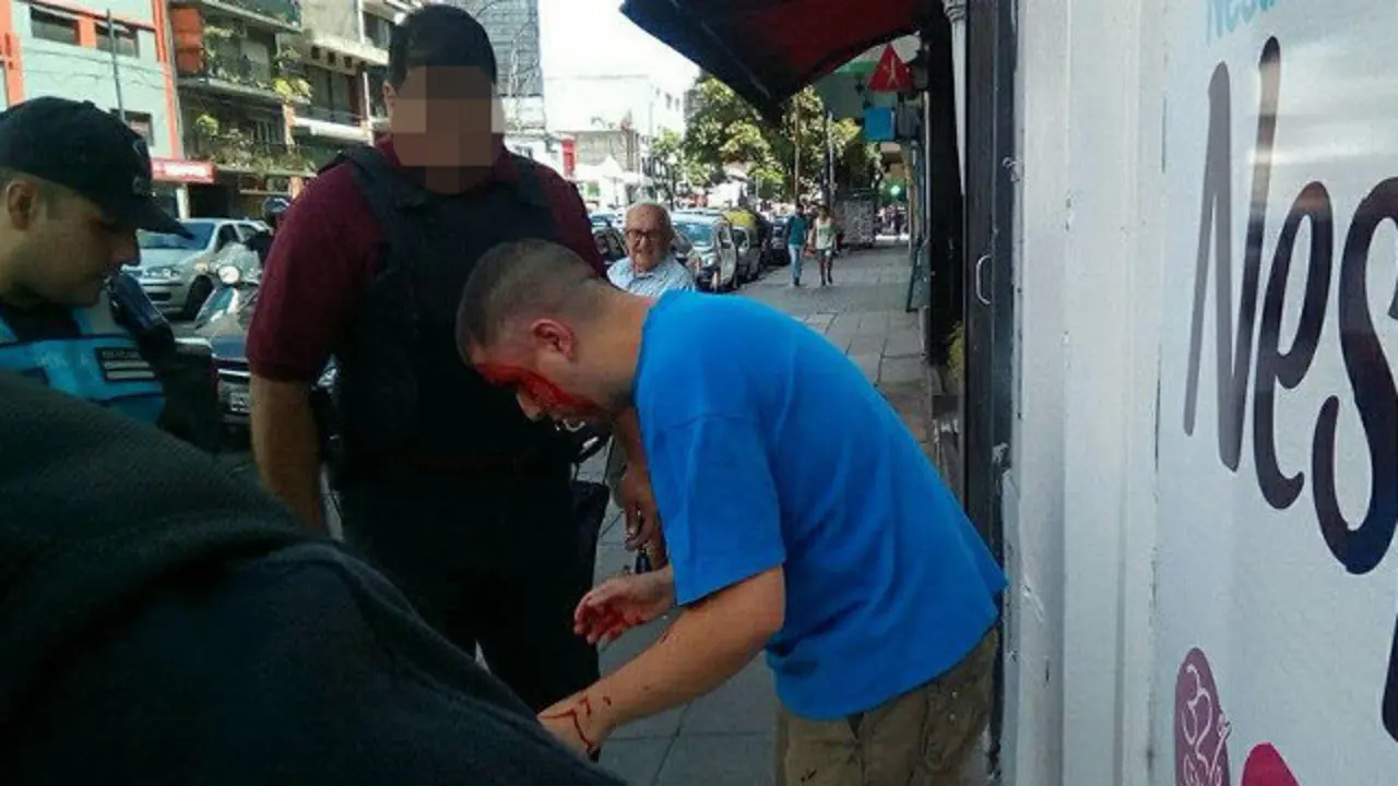 El acosador, tras ser golpeado por el padre de la niña. FACEBOOK