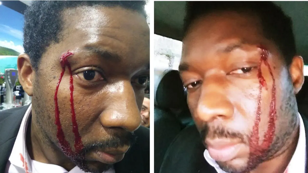 Marius Makon, tras la agresión. FACEBOOK