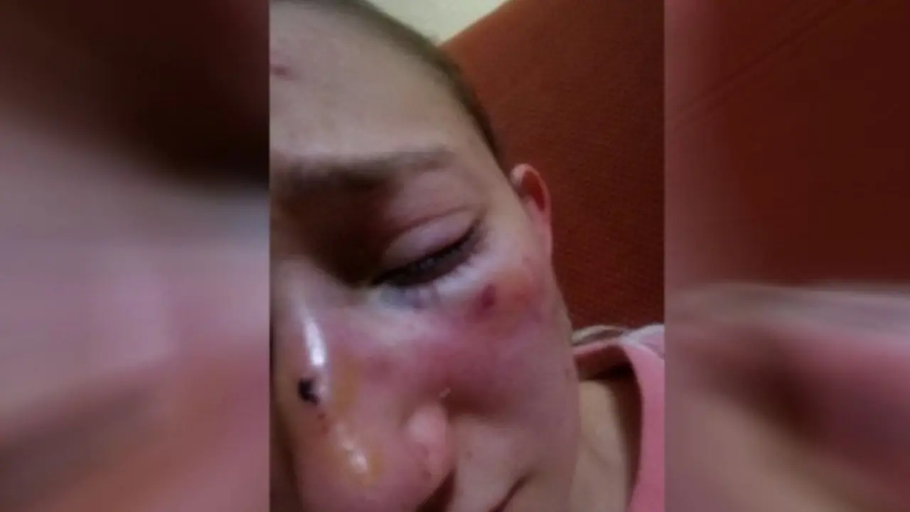 Moza agredida na Coruña. CRTVG.ES