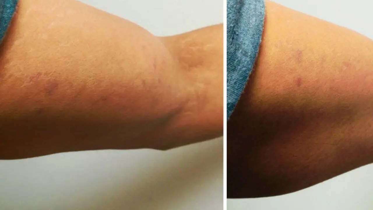 Varias heridas que presenta el denunciante tras el incidente con la Policía Local de Pontedeume.