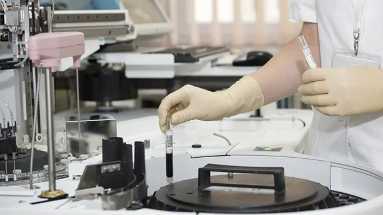 Pruebas de laboratorio. DP