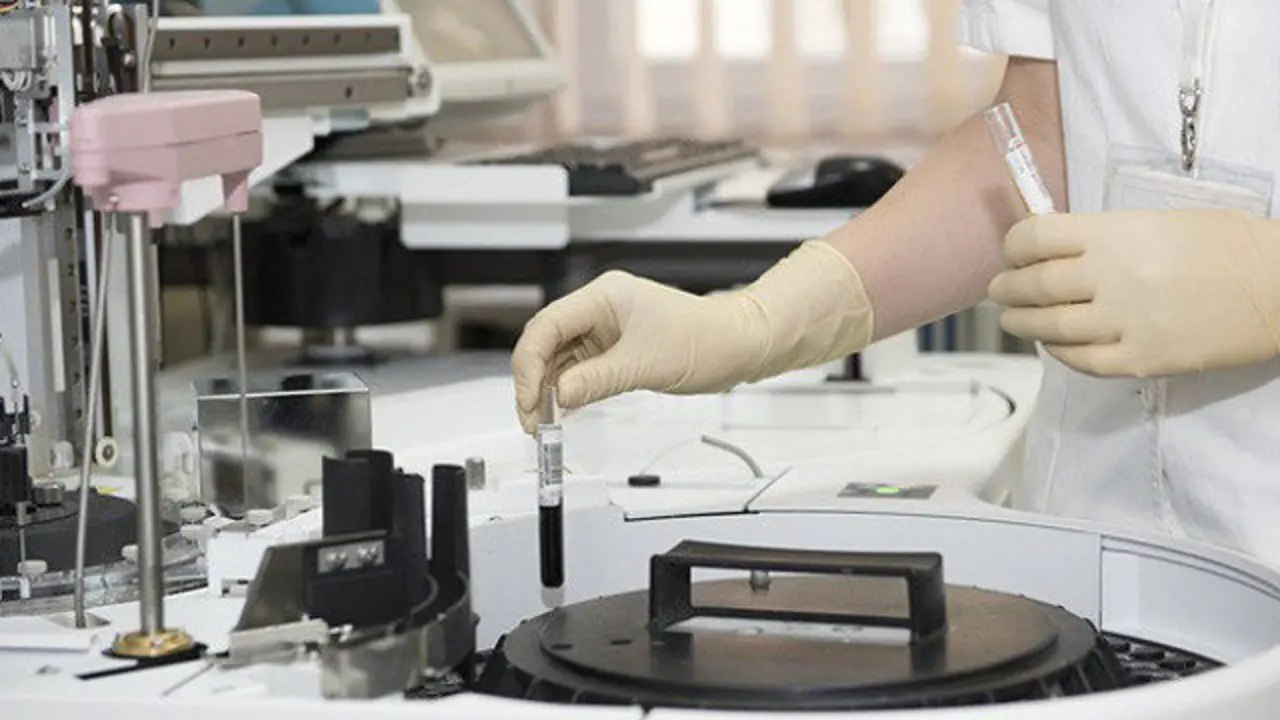 Pruebas de laboratorio. AEP (ARCHIVO)