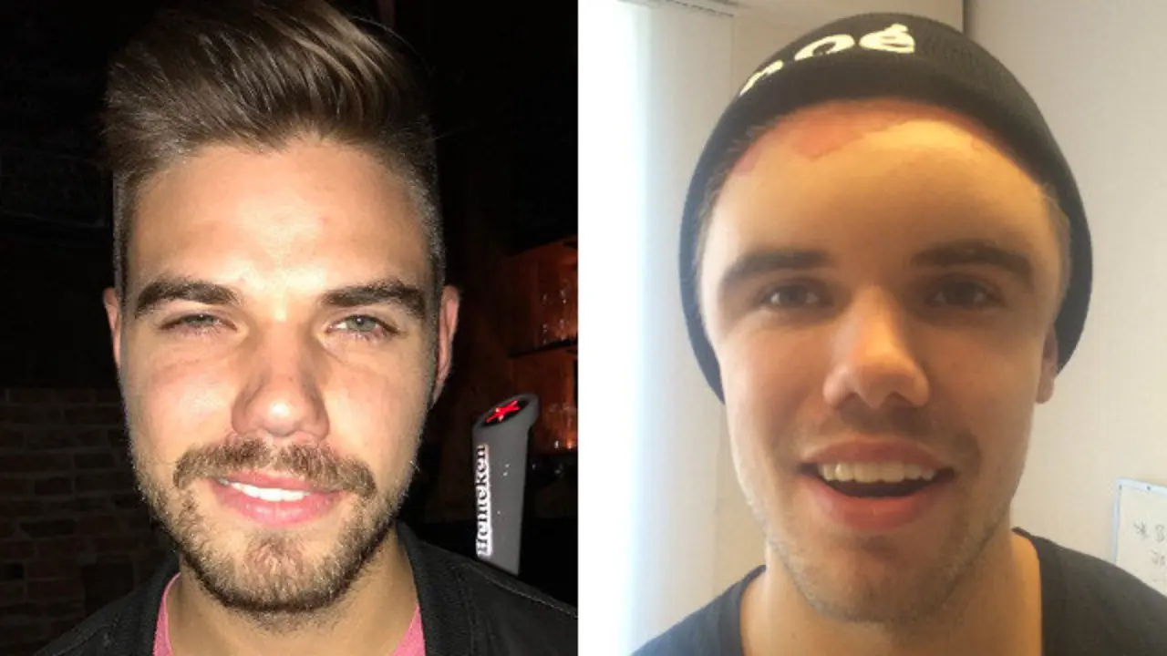 O mozo, antes e despois da reacción alérxica ao tinte. TWITTER