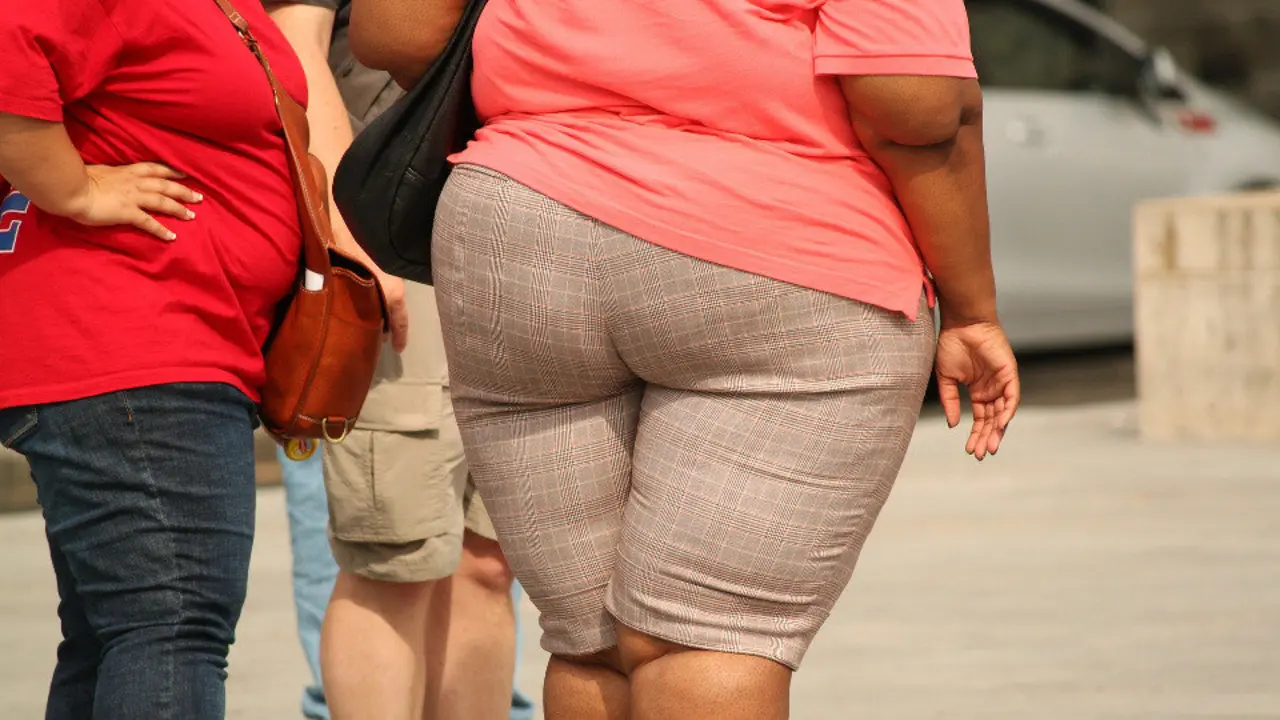 Persona con obesidad. AEP