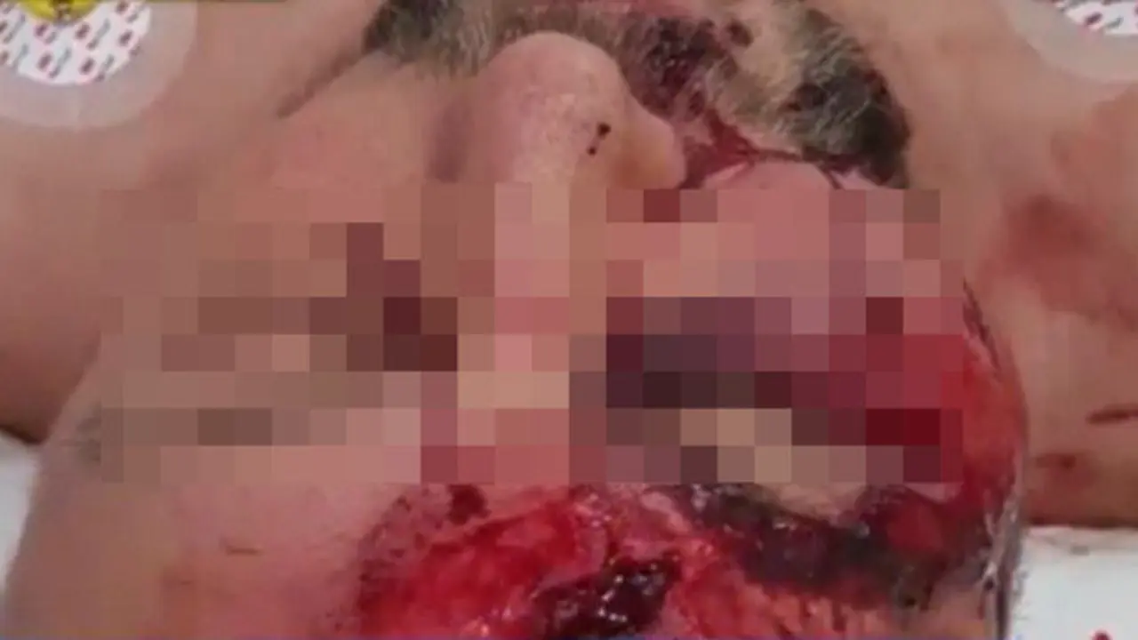 El líder de la ultraderecha alemana resultó herido de gravedad. EP