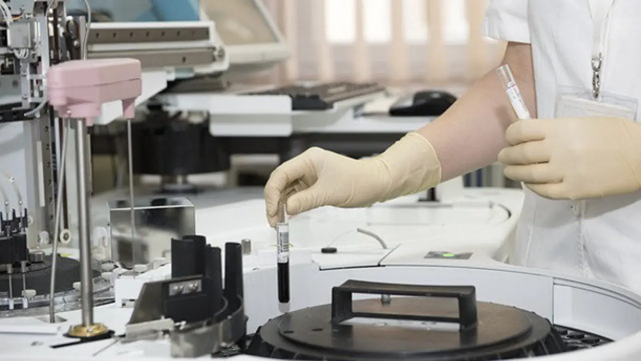 Pruebas de laboratorio. DP