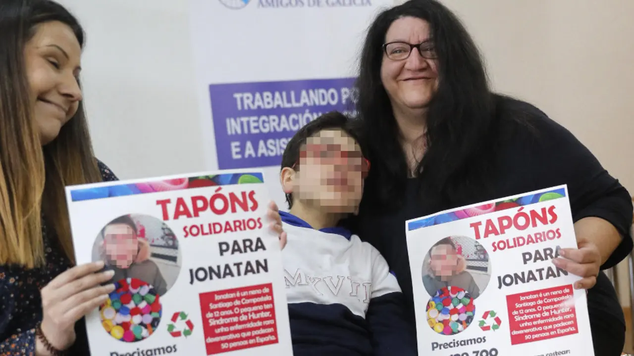 El pequeño Jonatan, de 12 años y que padece el sindrome de Hunter.LAVANDEIRA.JR (Efe)