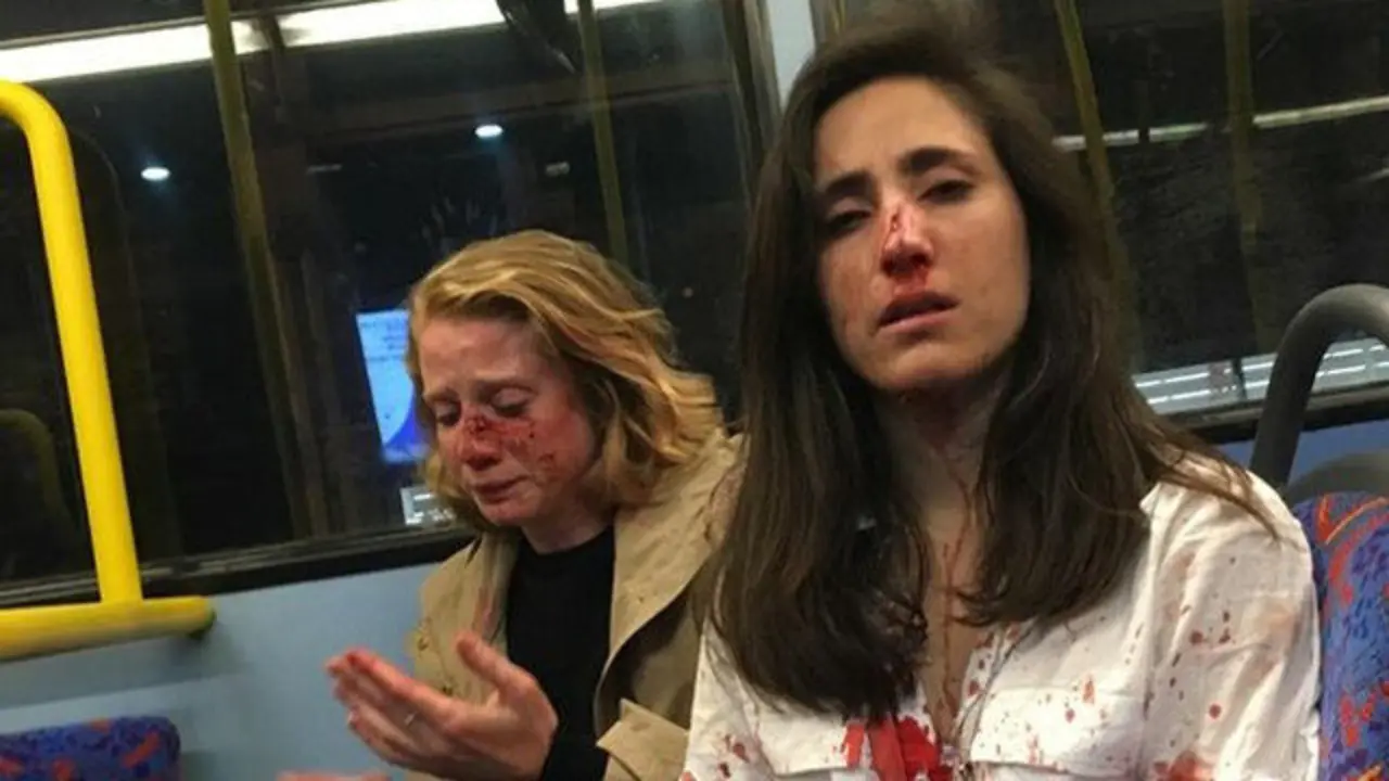 Melania Geymonat y su pareja Chris, ensangrentada tras la agresión. FACEBOOK