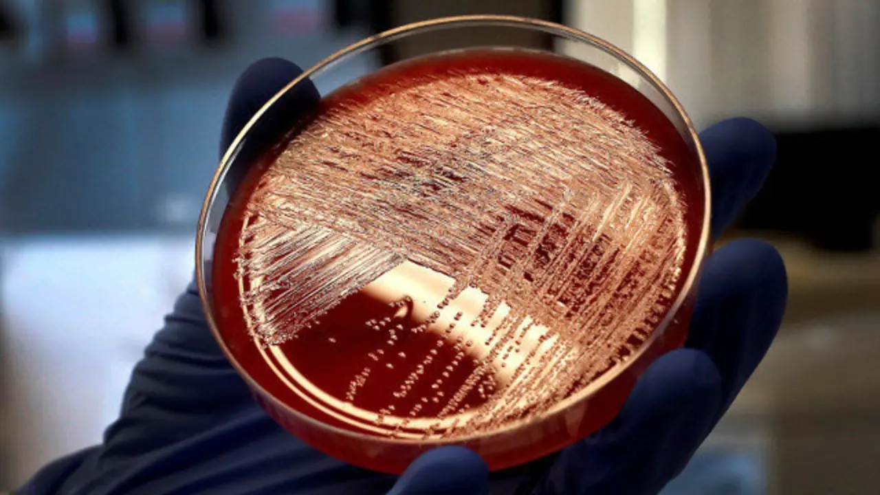 Un cultivo de listeriosis.CHEMA MOYA (Efe)