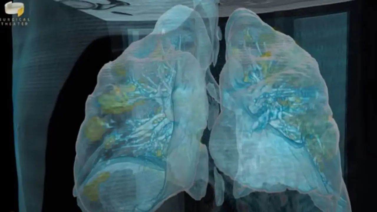 Un momento de la recreaci&oacute;n de los da&ntilde;os del coronavirus en los pulmones. GEORGE WASHINGTON HOSPITAL