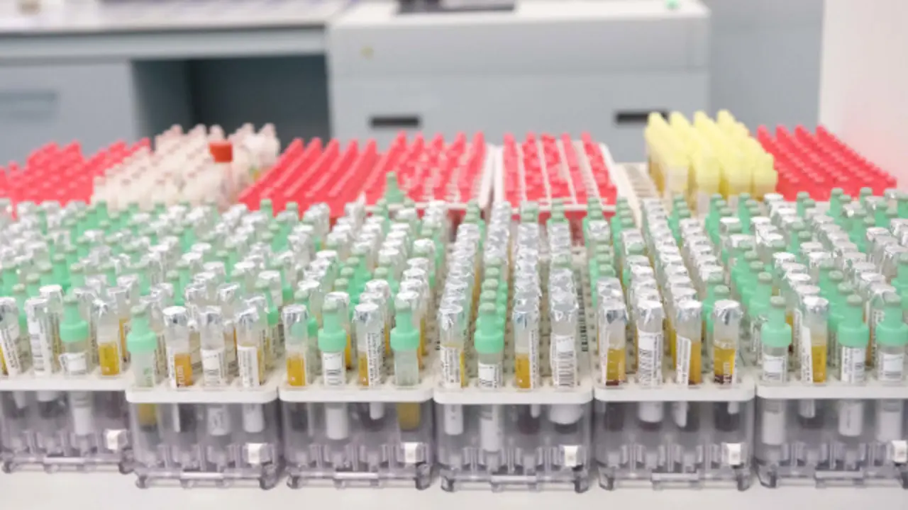 Proc/JFIF/EFE-Calidad:Excelente