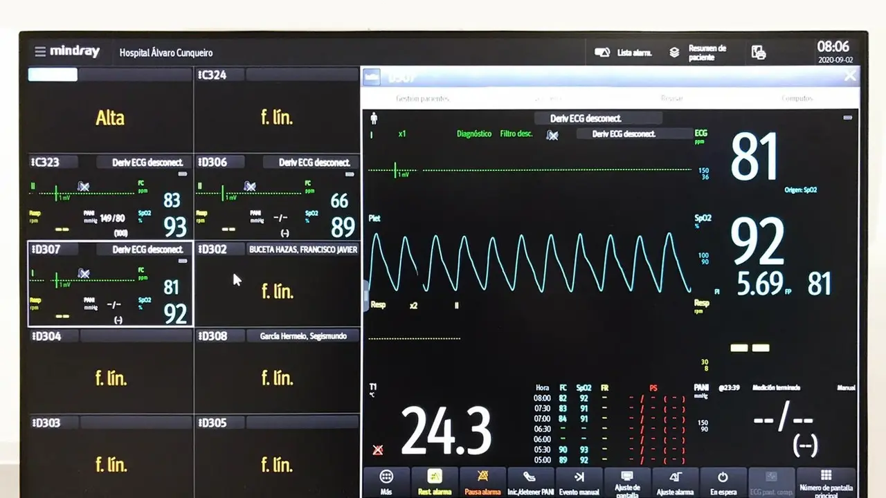 Uno de los equipos de montorización. EFE