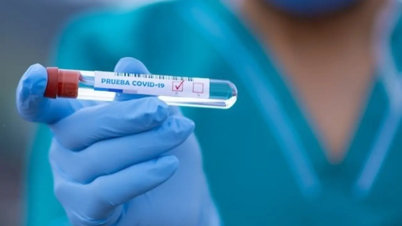 Proba para detectar o covid-19. EFE