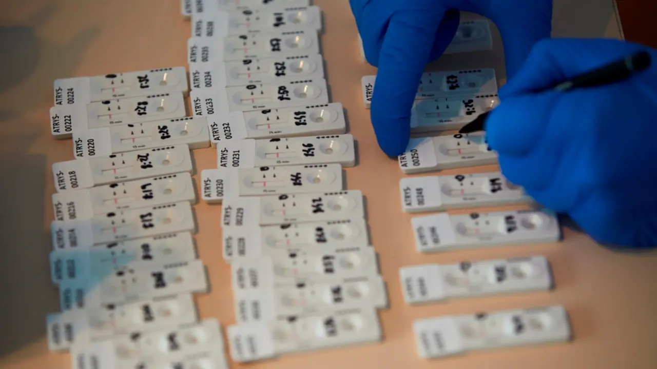 Test rápidos de detección de anticuerpos covid-19. ALEJANDRO GARCÍA (EFE)