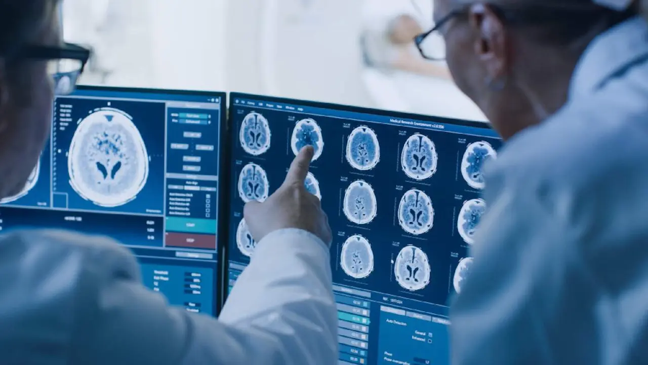 Un facultativo estudia unas imágenes del cerebro.EP