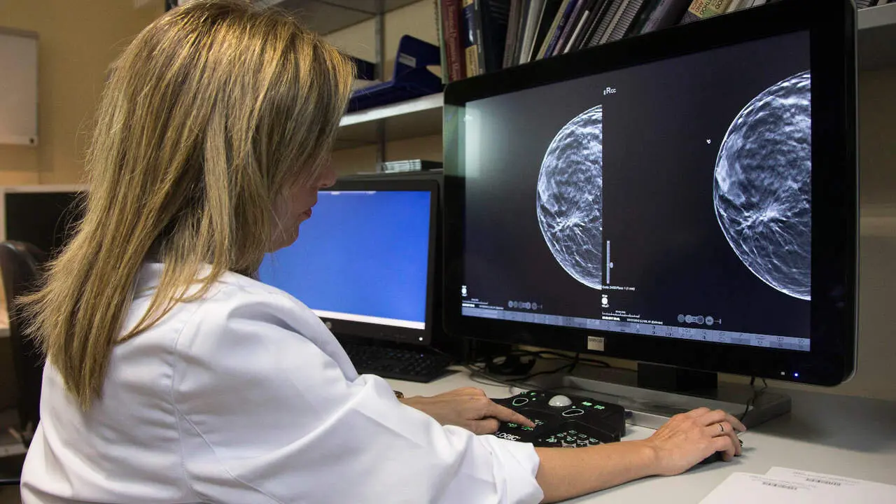 Una doctora muestra una mamografía. EFE