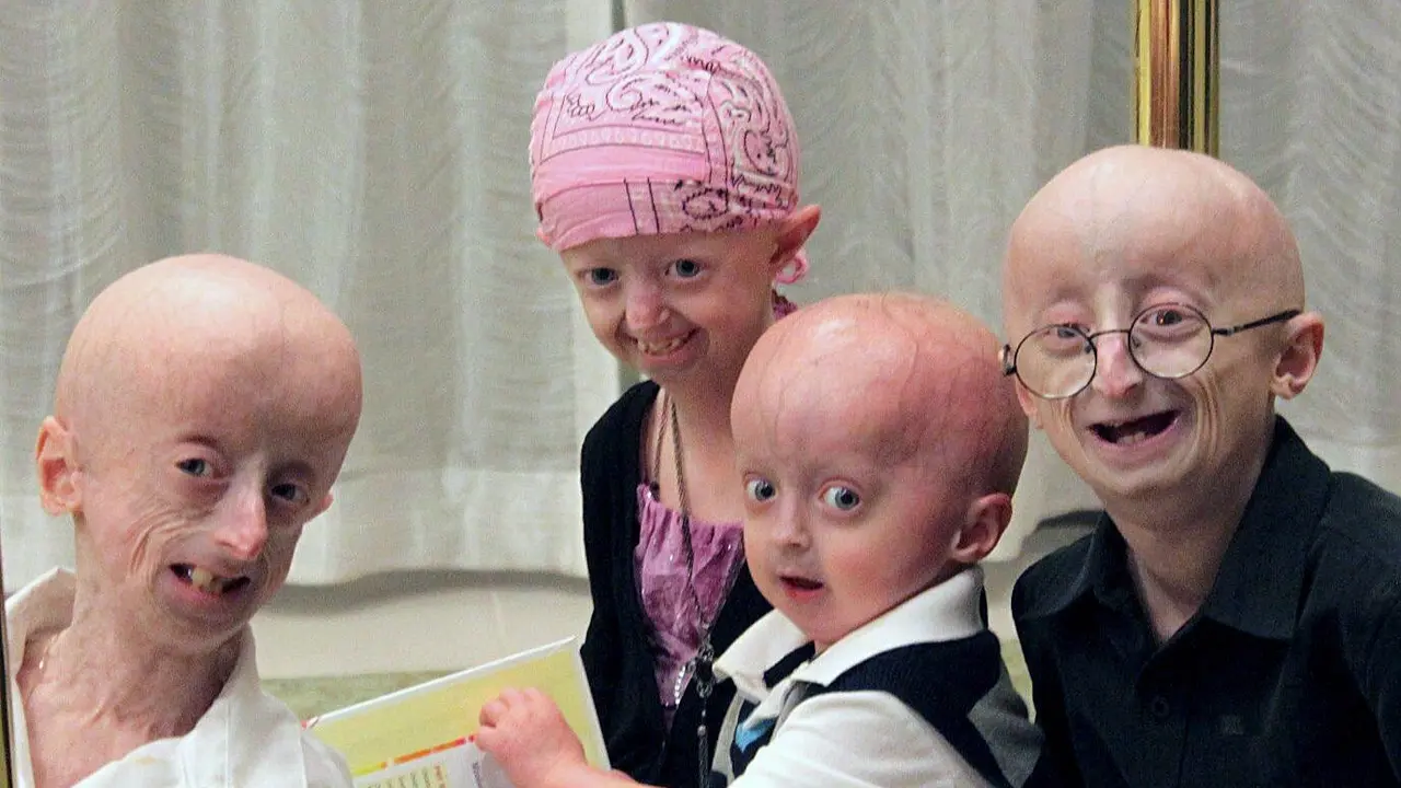 Fotografía de varios pacientes con progeria tomada en el año 2011. EFE/AEP