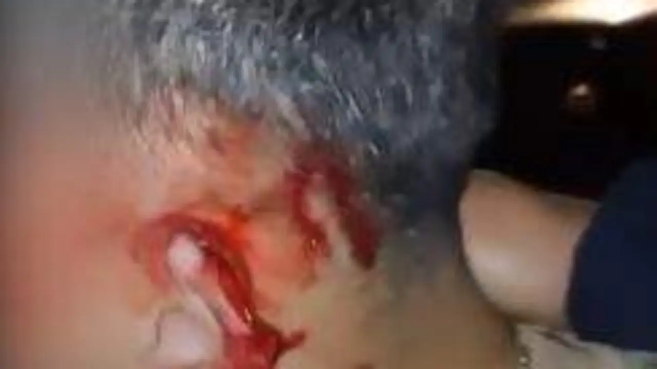 La oreja ensangrentada despu&eacute;s del mordisco. EP.