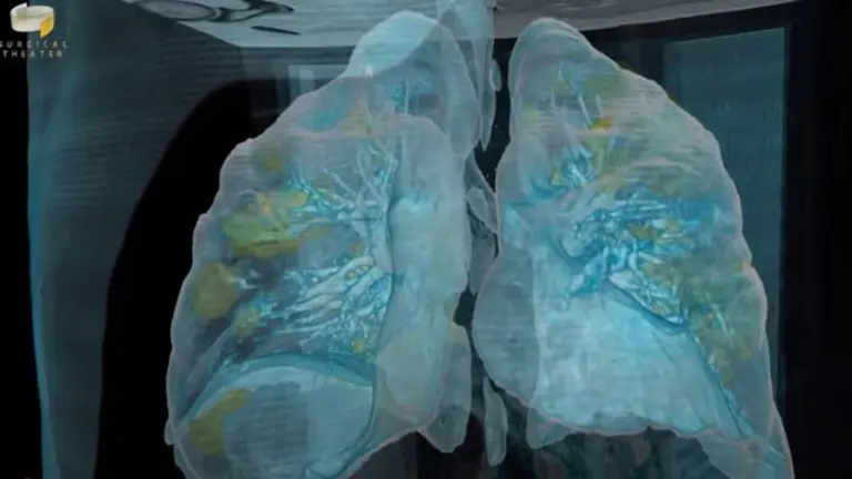Un momento de la recreaci&oacute;n de los da&ntilde;os del coronavirus en los pulmones. GEORGE WASHINGTON HOSPITAL
