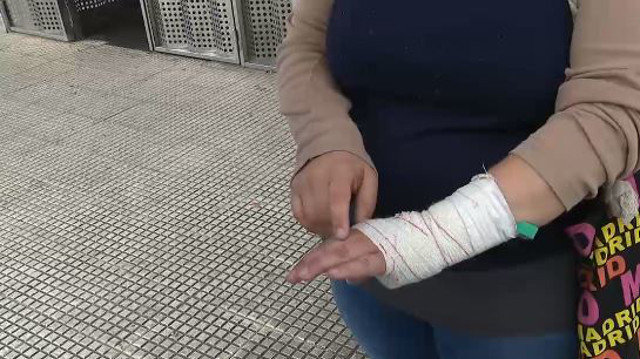 La mujer que denunció una agresión de Manuel Charlín. TVG