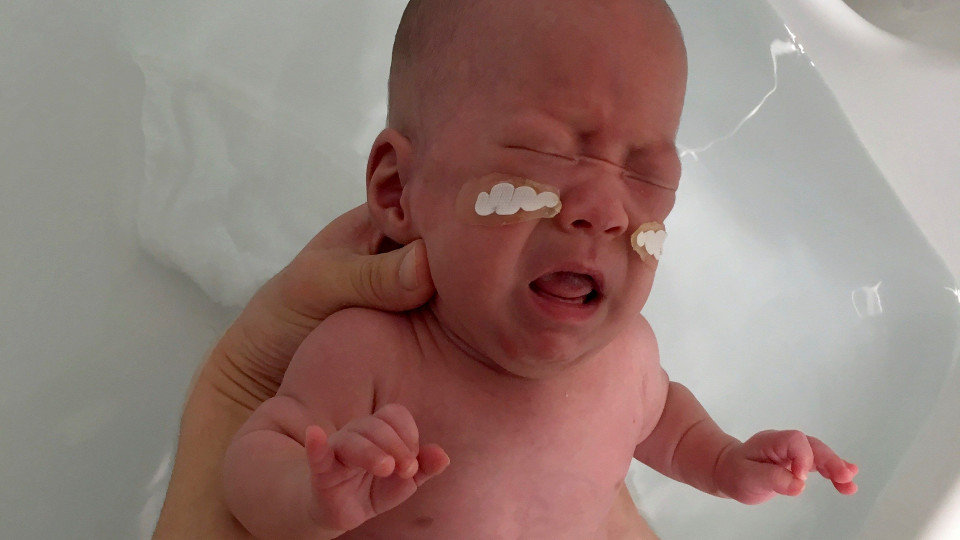 El bebé más pequeño del mundo en sobrevivir a un parto prematuro. TAKESHI ARIMITSU (EFE)