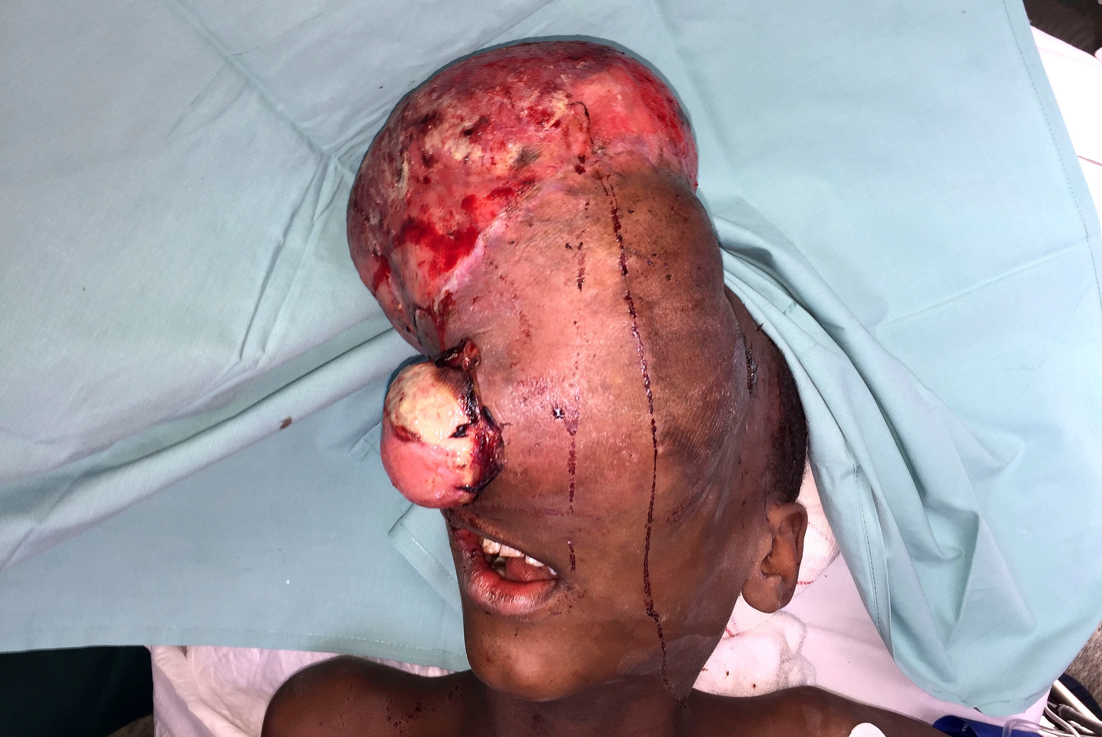 Aspecto que presentaba o tumor do pequeno.EFE